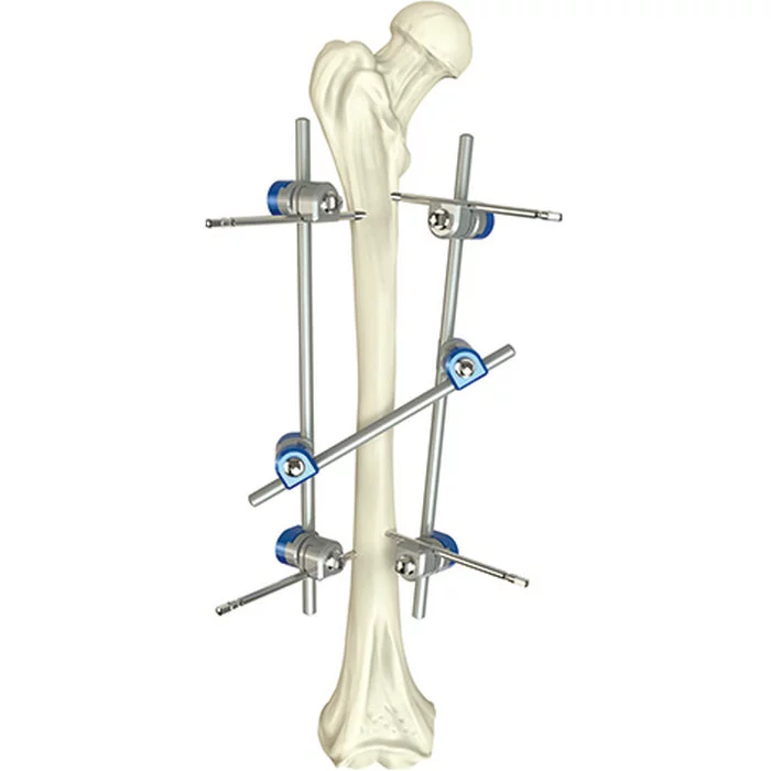 La qualité a assuré les instruments médicaux chirurgicaux médicaux externes de Fixator d'axe fémoral orthopédique de base d'instrument chirurgical
