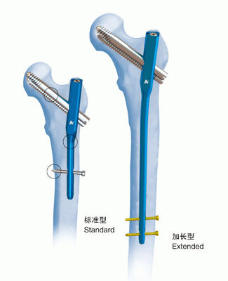 Clou de verrouillage gamma PFN de titaneⅣ d'orthopédie