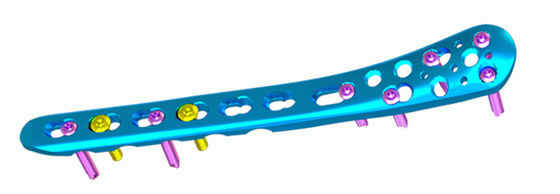 Plat de verrouillage proximal de tibia de plat médial distal titanique de tibia