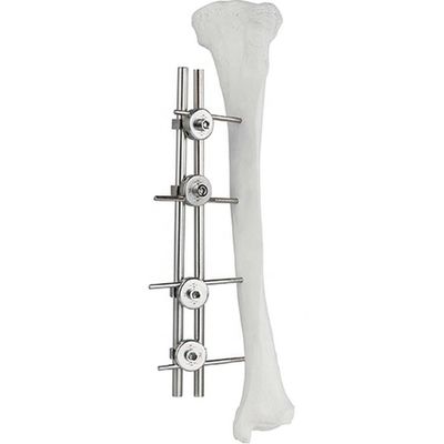 Chirurgie externe Tibial Fixator d'os de Fixator de fémur orthopédique d'implant