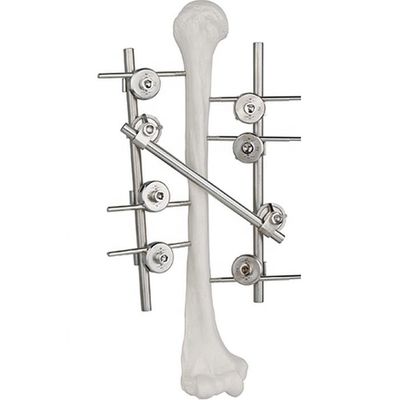 Implant chirurgical orthopédique externe huméral titanique de dispositif de fixation