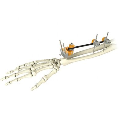 Fixation externe de cubitus de fracture distale orthopédique médicale de rayon