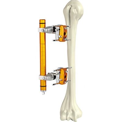 Axe huméral orthopédique médical Fixator externe d'instruments chirurgicaux