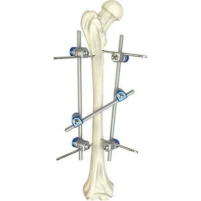 L'instrument orthopédique de base a placé le dispositif de fixation externe d'axe fémoral chirurgical