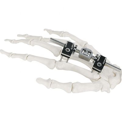 Dispositif chirurgical orthopédique de Mini Fragment Ilizarov External Fixation