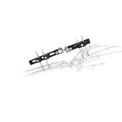 Poignet externe chirurgical orthopédique de dispositif de fixation