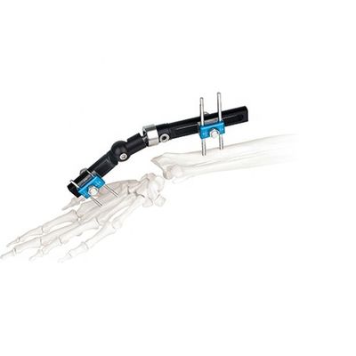 Poignet externe chirurgical orthopédique de dispositif de fixation