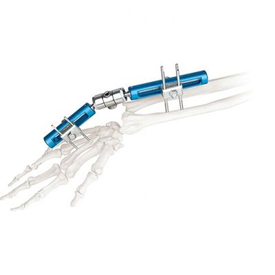 Poignet externe chirurgical orthopédique de dispositif de fixation