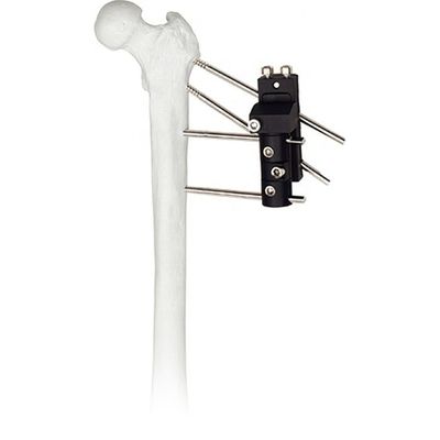 Une plus grande image de vidéo-iconimage d'image de vue s'ajoutent à l'articulation de la hanche orthopédique d'instruments chirurgicaux de prix concurrentiel de CompareShare
