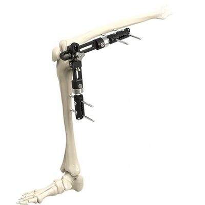 Fixation externe externe orthopédique de haute qualité Instrumen chirurgical orthopédique de Fixator d'articulation du genou d'instruments chirurgicaux