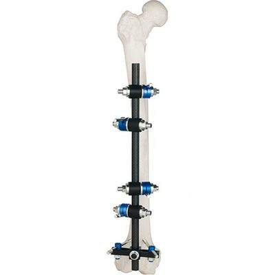 Fémur Fixator externe Tibial