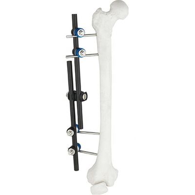 Instruments chirurgicaux orthopédiques de vente chaude Tibial et instrument orthopédique de fixation externe externe de Fixator ao de fémur