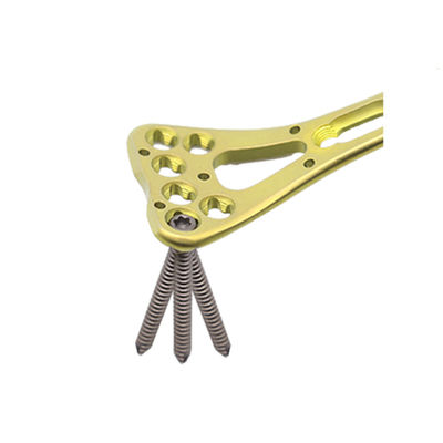 Plat distal II de fracture de rayon de paume axiale multi de traumatisme