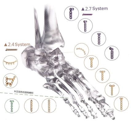 Plat de verrouillage titanique orthopédique de fracture d'implant le pied de mains