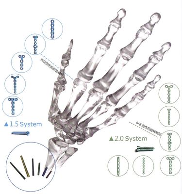 Plat de verrouillage titanique orthopédique de fracture d'implant le pied de mains