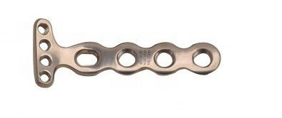 Instrument orthopédique de chirurgie de verrouillage de rayon distal Volar latéral médical de plat