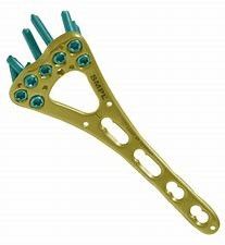 Fixation distale de plat de fracture de clavicule d'Accumed de clavicule de crochet d'épaule