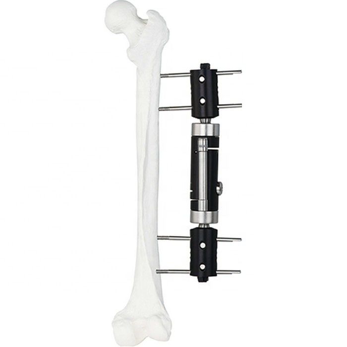Type droit dispositif ex externe d'implant médical orthopédique de difficulté de Fixator