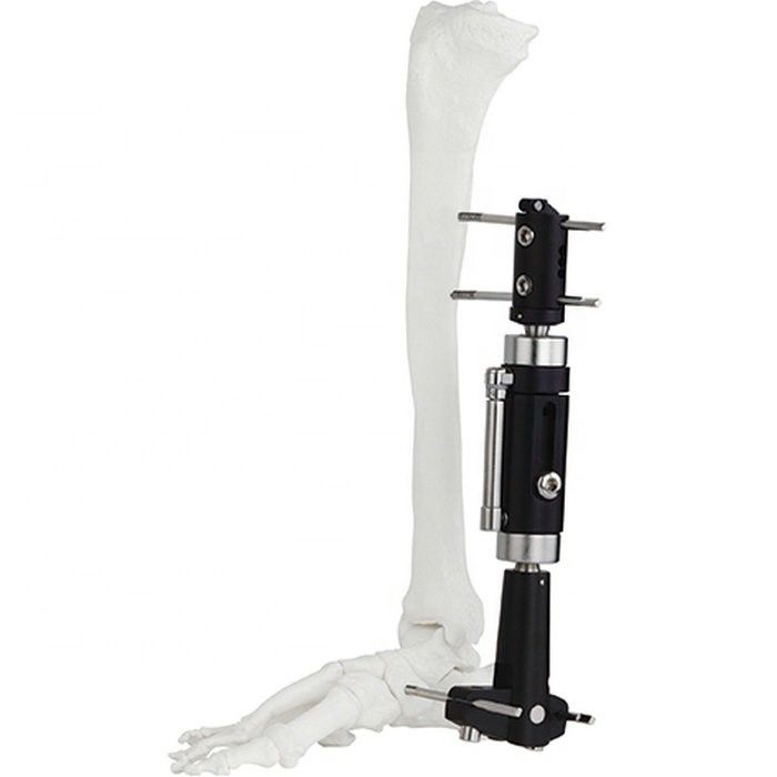 Fixation externe externe Instrum chirurgical de Fixator de qualité d'instruments chirurgicaux de la cheville de fragment orthopédique assurément d'articulation