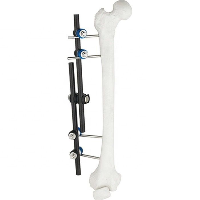 Instruments chirurgicaux orthopédiques de vente chaude Tibial et instrument orthopédique de fixation externe externe de Fixator ao de fémur