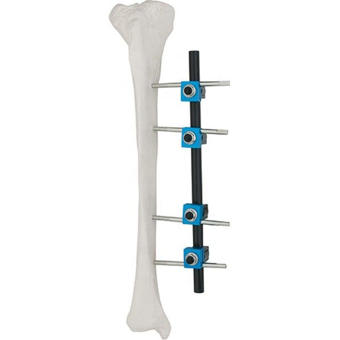 La qualité a assuré l'implant orthopédique d'instruments chirurgicaux de fixation externe externe Tibial orthopédique de Fixator ao
