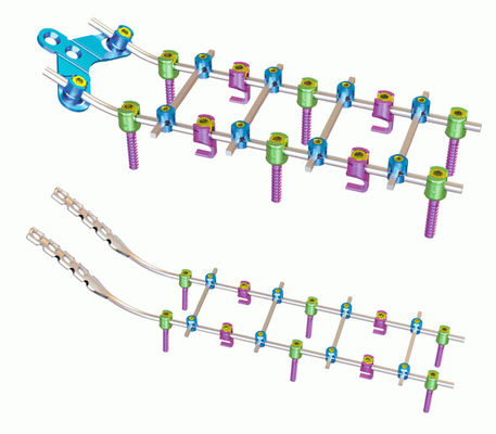 Système cervical postérieur de fixation d'orthopédie titanique
