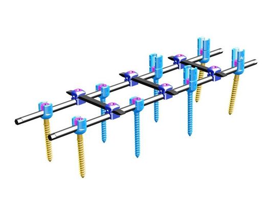 Système spinal de fixation de fixationⅣ interne spinale d'orthopédie