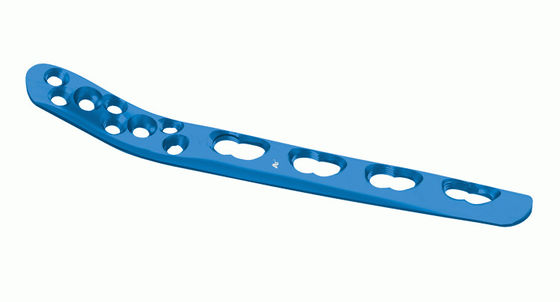 Dispositifs de fixation Fibular distaux de traumatisme de plat de verrouillage de Posterolateral