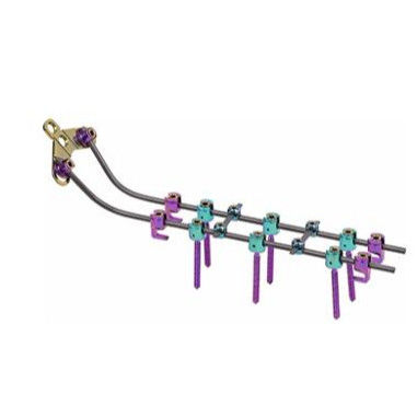 Les vis cervicales postérieures de système de Vertebar Rods insèrent le dispositif de fixation d'épine
